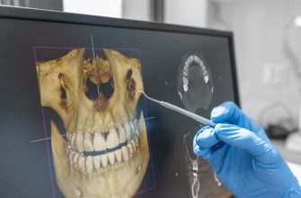 Трехмерная 3D-модель челюсти по результатам компьютерной томографии